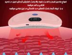 ماساژور قاعدگی گرم کننده لونار مشخصات : توان مصرفی : 5 وات نوع ماساژ:لرزشی , گرمایی سایر توضیحات:با دوبار فشار دادن کلید پاور ( به شکل یک دایره و یک خط درون آن) دستگاه آماده به کار میشود. با یکبار فشردن دما( سمت چپ کلید پاور) میتوانید دما را از 50 تا 60 درجه افزایش دهید. کلید ماساژ لرزشی ( سمت راست کلید پاور) دارای چند حالت ماساژ است که با هر بار فشر تقییر میکند کانال ایتا :  https://eitaa.com/kharraziaramis ماساژور قاعدگی ماساژور پریودی ماساژور گرمایی قاعدگی ماساژور گرمایی پریودی ماساژ مخصوص بانوان ماساژور بانوان قاعدگی ماساژورقاعدگی 